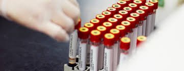 MALARGÜE TIENE DOS CASOS MÁS DE CORONAVIRUS POSITIVO